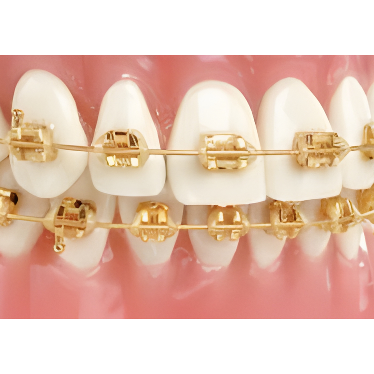Mini-Gold-Twin-Bracket-System-24-karat-K-Plated-Typodont