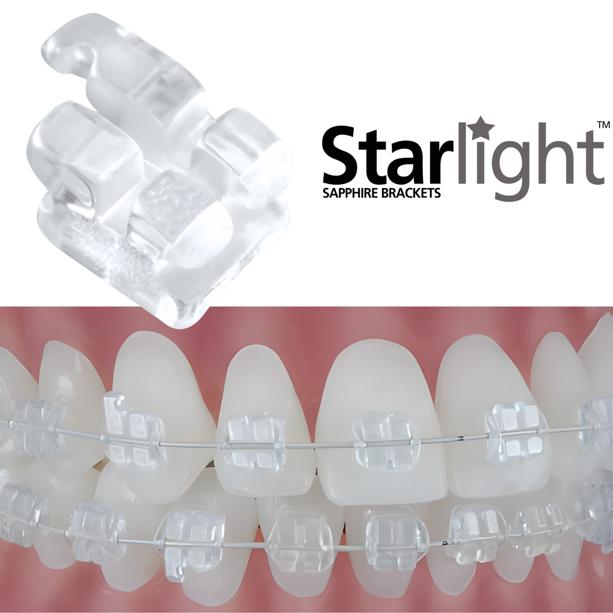 Starlight-Sapphire-Brackets-Clear-Braces-Twin-Brackets-Ceramic