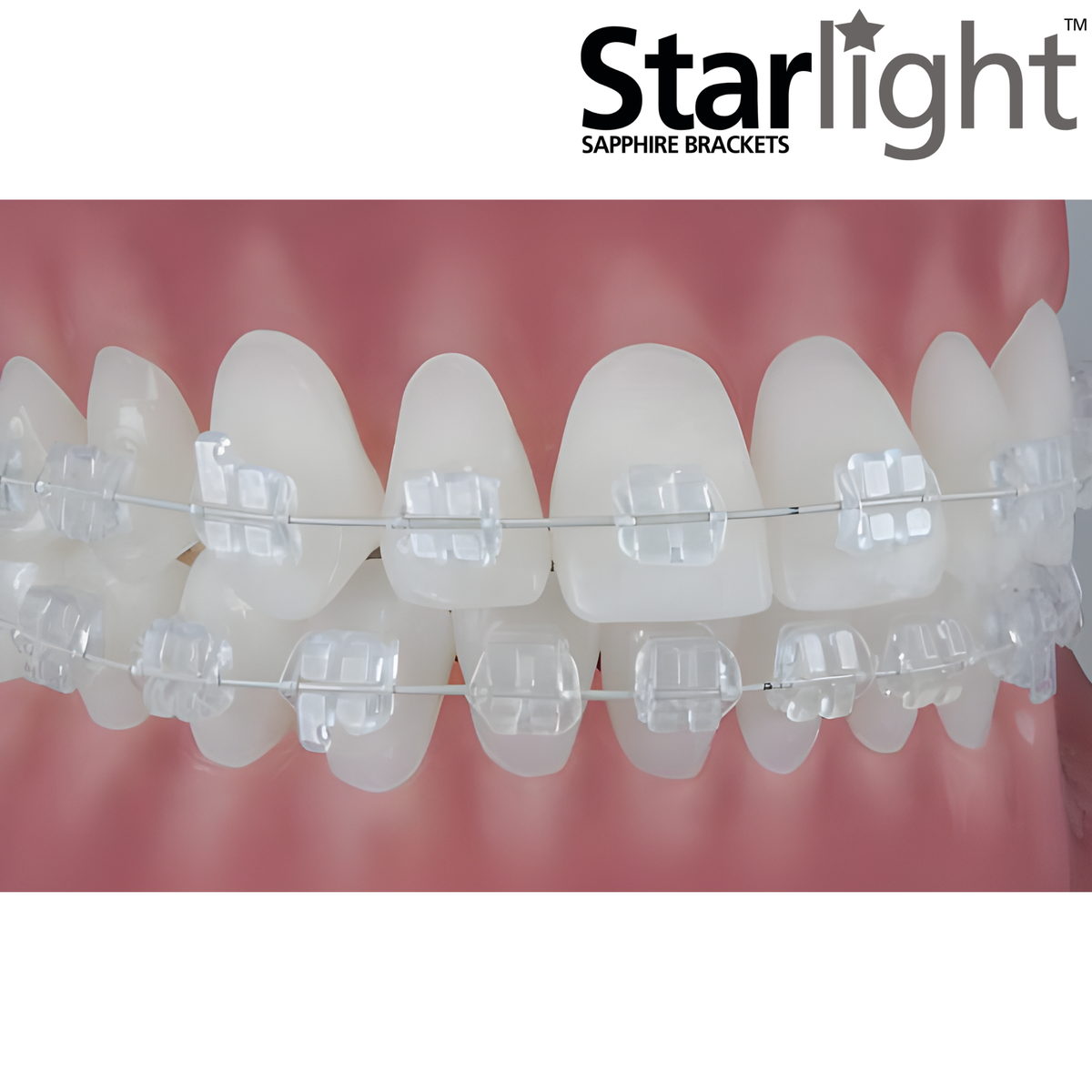 Starlight-Sapphire-Brackets-Clear-Braces-Twin-Brackets-Ceramic-Invisible-Braces