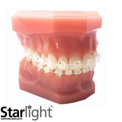 Starlight-Sapphire-Brackets-Clear-Braces-Twin-Brackets-Ceramic-Invisible-Braces-On-Typodont